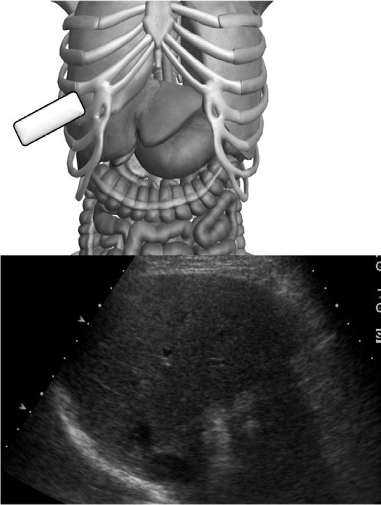 좌우간문맥분지의횡스캔 2. 간외담관의종스캔 3. 담낭의장축 4. 간정맥의늑간하스캔 5. 간좌엽의종스캔 6.