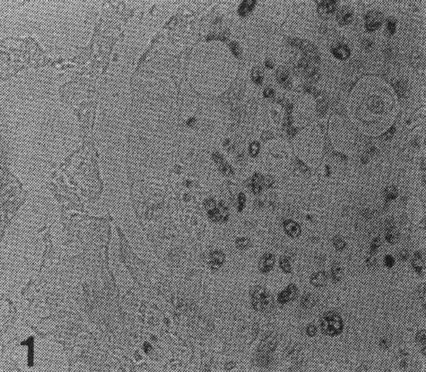 A photomicrograph shows the expression of PCNA in the nuclei by the AEC as a detection system.
