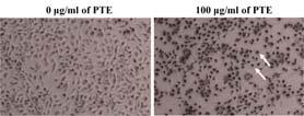 28 大韓本草學會誌 Vol. 30 No. 2, 2015 태로대부분존재하였고 apoptotic cell은 2.5% 였으나, PTE로처치된세포는 29.5% 의 apoptotic cell population을나타내어 PTE에의한 YD-10B 세포사멸에 apoptosis signaling 이유의하게 (p<0.01) 관여함을알수있었다 (Fig. 2B).