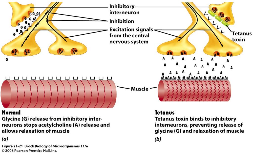 The action of tetanus toxin from Clostridium tetani. <Motor neuron> Muscle relaxation is normally induced by glycine (G) release from inhibitory interneurons.