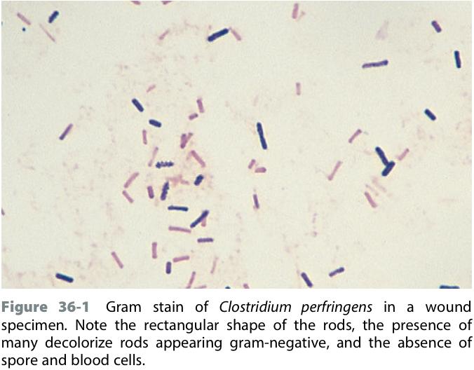 Clostridium perfringens 일반적 특징 - 조직 독성 Clostridium중 가장 흔함 : myonecrosis의 60-90% - 흙, 물, 하수; 포유류 및 조류의 장관 내 존재 - 단순한