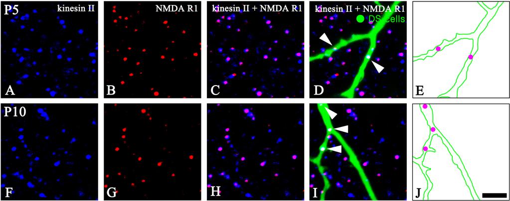 NMDA R1와 kinesin II에 대해 이중표지 (double labeling) 했을 때, NMDA R1에 대한 면역반응반 점들은 kinesin II-labeled ribbon들과 일치하였다. Fig.