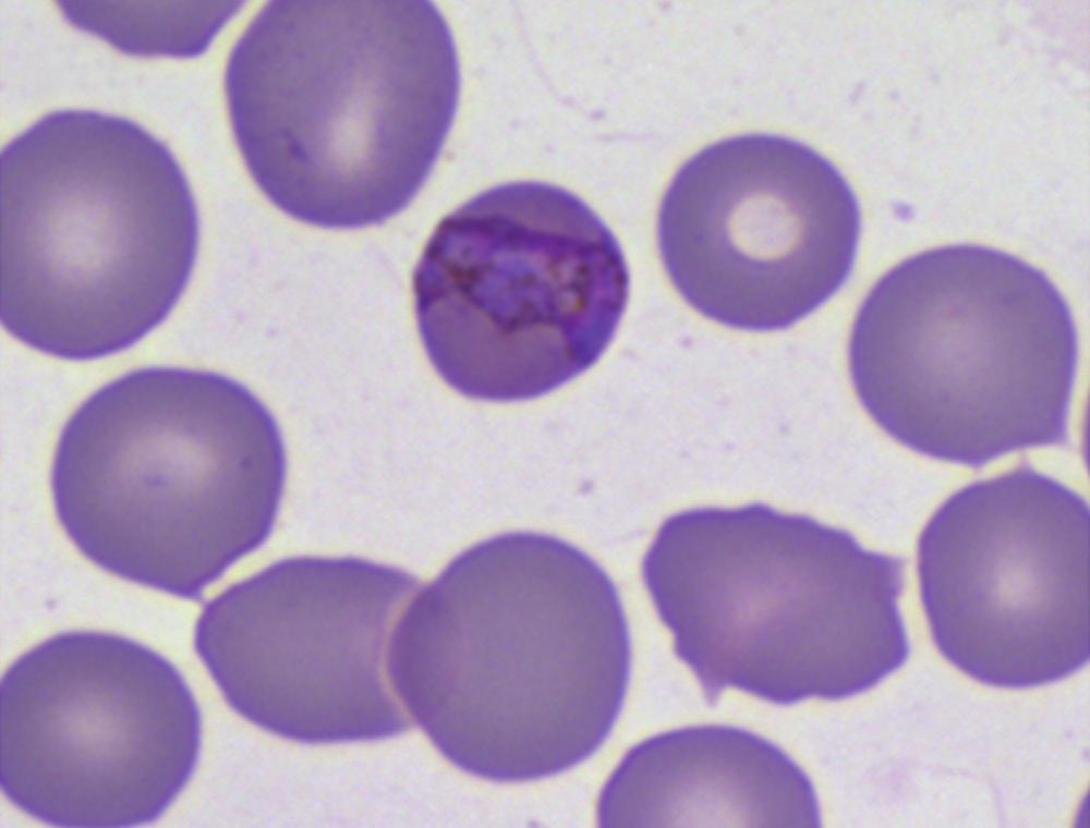 말라리아원충의농도는현미경 1,000 배율에서백혈구 200개당원충의수를센후자동혈구분석기 (XE-2100 hematology analyzer, Sysmex, Japan) 로측정한백혈 구수로 μl당원충의수를간접계산하였고 109/μL로계산되었다.