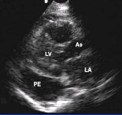 wall () of the left ventricle. Figure 3.