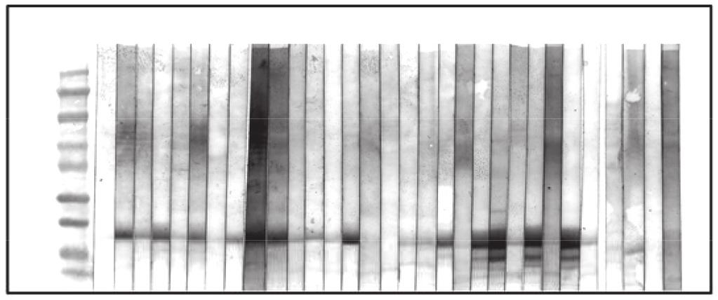 KDa M T2 T3 175 125 52 39 19 13 9 Bet v 6 (35 kda) Bet v 1 (17 kda) Bet v 2 (14 kda) Fig. 1. Sodium dodecyl sulphate-polyacrylamide gel electrophoresis finding of alder and birch pollen extracts.