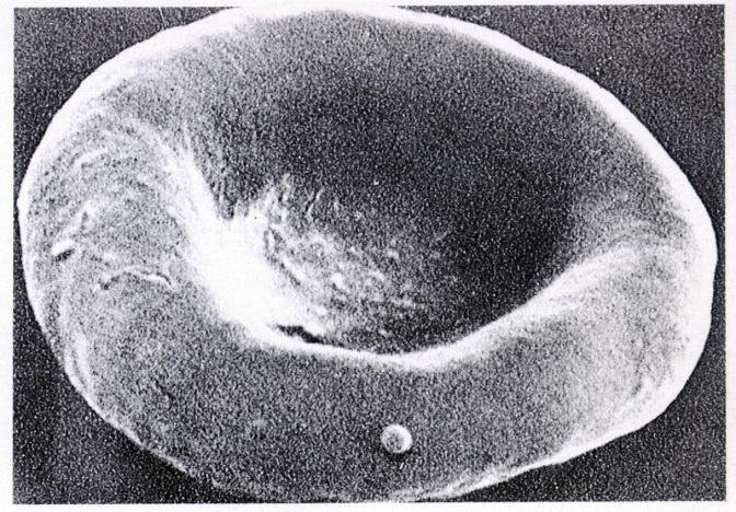 B. 적혈구 1. 적혈구의특성 1) 형태적특성 - biconcave disc: 직경 Ca.