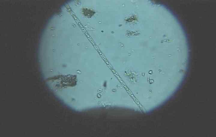 Microcystis aeruginosa -