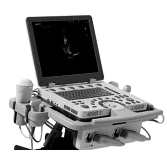 보건산업브리프 국내 2) A26380 초음파영상진단장치 A26380.01 범용초음파영상진단장치 [2] Ultrasound imaging system, general-purpose A26380.02 두부용초음파영상진단장치 [2] Ultrasound system, imaging, head A26380.