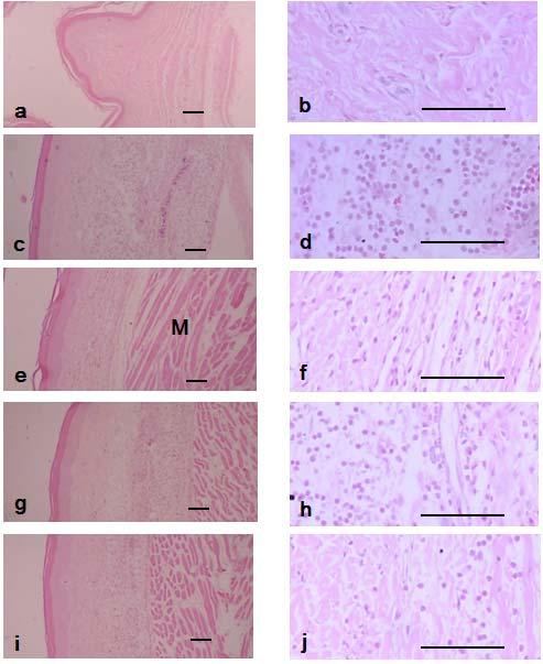 이태호 조미정 박숙자 이종록 백영두 김종열 권영규 김상찬 Fig. 8. Changes on histological profiles of the Ventrum Pedis skin in normal control (a, b), Carrageenan control (c, d), Dexamethasone (e, f), HYSE 0.