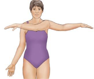 2) 유방암과운동중재 (2) 견관절기능강화 Abduction( 외전 ) 어깨근육스트레칭과저항성운동을한그룹에서어깨관절가동범위가향상됨