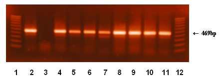 Fig. 4. Detection of C. sakazkaii by amplification of ompa gene. Lanse; 1,12 : 100 bp ladder, 1: C. sakazkaii ATCC 29544(positive control), 2: E.
