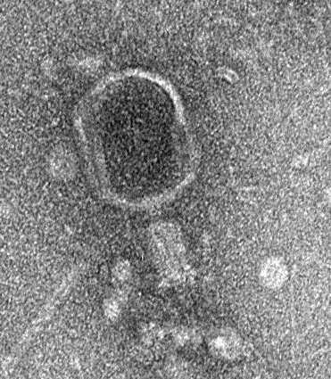 EI-I phage