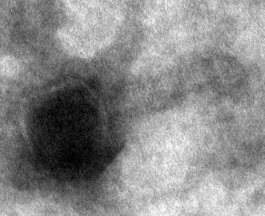 2949-1 phage ES-I
