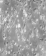 김현정외 8 인. Establishment of a novel malignant Brenner tumer cell line Fig. 2. Microscopic findings of OHK cell line.