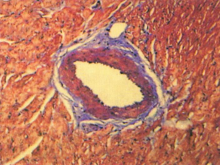 trichrome (upper panel)