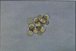 Rapid slide crossmatching 각