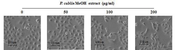 (B) A549 cell morphology was visualized after P. cablin extract treatment by light microscopy. Magnification, 100. *p<0.05 and **p<0.01 as compared with the control. 의존적으로생존율이감소되었다.