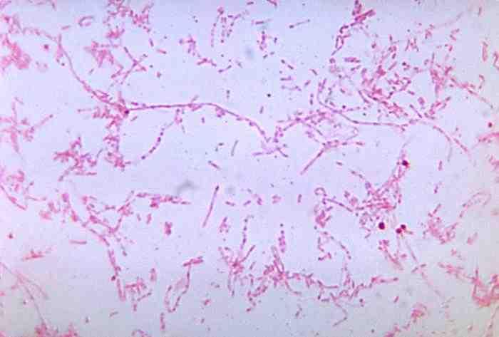 2017 병원체생물안전정보집 ( 제 2, 3, 4 위험군 ) 38 Fusobacterium necrophorum 위험군 : 제 2위험군 국내범주 :- 특성 :Fusobacteriaceae과, 그람음성, 막대균, 포자형성안함, 무산소성 출처 :CDC/ Dr. V.R. Dowell, Jr.