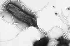 2017 병원체생물안전정보집 ( 제 2, 3, 4 위험군 ) 41 Helicobacter pylori 위험군 : 제 2위험군 국내범주 :- 특성 :Helicobacteraceae과, 그람음성, 나선형세균, 양극형편모, 운동성있음, 미산소성 출처 :http://info.fujita-hu.ac.jp/~tsutsu mi/photo/photo002-6.