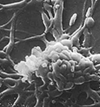 세균 01 51 Mycoplasma spp. 출처 :http://epidemics.psu.edu/article s/view/bordetella-parapertussis-surviv es-in-macrophages-in-lipid-raft-enric hed-pha, Rottem et al.