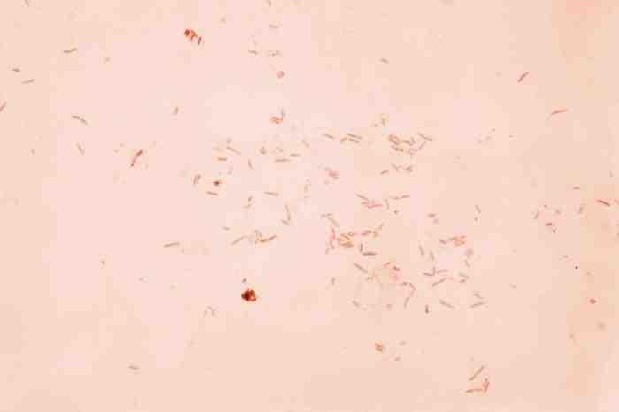 2017 병원체생물안전정보집 ( 제 2, 3, 4 위험군 ) 58 Plesiomonas shigelloides 위험군 : 제 2위험군 국내범주 :- 특성 :Enterobacteriaceae 과, 그람음성, 조건무산소성, 막대균, 극편모가있어운동성있음 출처 :CDC/ Dr. W.A.