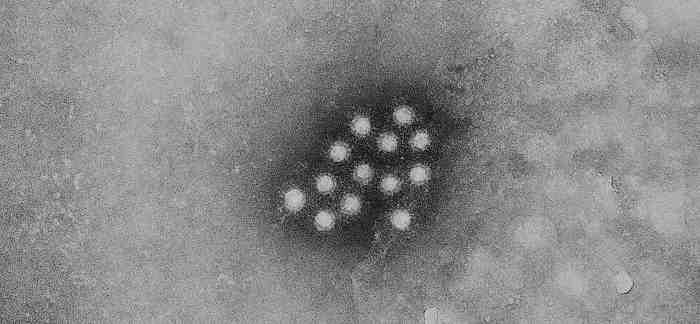 바이러스 02 17 Hepatitis A virus(hepatovirus A) 위험군 : 제 2위험군 국내범주 :- 특 성 : 과, 속, (+)ssrna, 외피없음 출처 :CDC/ Betty Partin 병원성및감염증상 잠복기 :15~45일 급성감염질환인 A형간염 (viral hepatitis A) 를유발함 발열, 식욕감퇴,