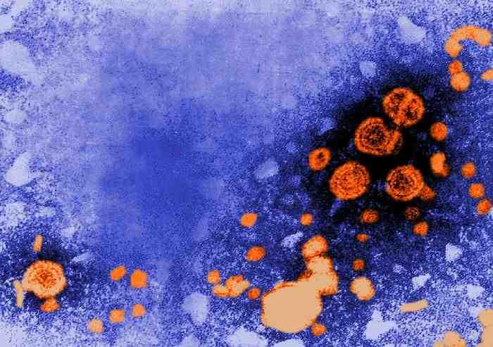 바이러스 02 18 Hepatitis B virus(hbv) 위험군 : 제 2위험군 국내범주 :- 특성 : 과, 속, dsdna, 외피있음 출처 :CDC/ Dr.