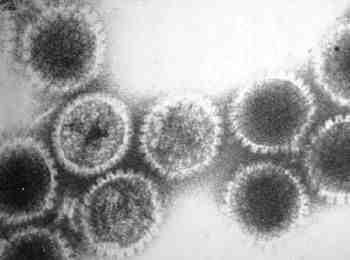 바이러스 02 23 Herpesvirus simiae(herpesvirus B, Monkey B virus, Cercopithecine herpesvirus 1, B virus) 위험군 : 제 4위험군 국내범주 : 고위험병원체 특 성 : 과, 속, dsdna 바이러스, 20 면체외피로둘러싸여있음 출처 :http://web.stanford.
