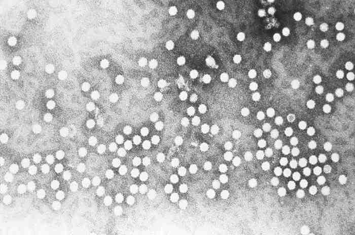 바이러스 02 33 Human parvovirus(b19) 위험군 : 제 2위험군 국내범주 :- 특성 : 과, 속, ssdna, 외피없음 출처 :CDC/ R. Regnery;E. L.