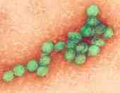 바이러스 02 75 West Nile virus 위험군 : 제 3위험군 국내범주 :- 특 성 : 과, 속, 20 면체, (+)ssrna 바이러스, 피막있음 출처 :CDC/ P.E. Rollin 병원성및감염증상 잠복기 : 보통 2~14일, 최대 21일 급성중추신경계질환인웨스트나일열 (West Nile fever) 을유발함 대부분이무증상또는가벼운증상을보임.