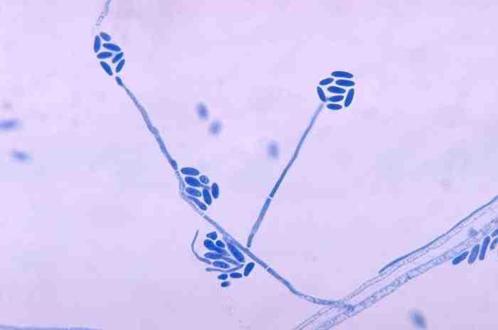 2017 병원체생물안전정보집 ( 제 2, 3, 4 위험군 ) 03 진균 1 Acremonium spp. ( 구 Cephalosporium spp.) A.