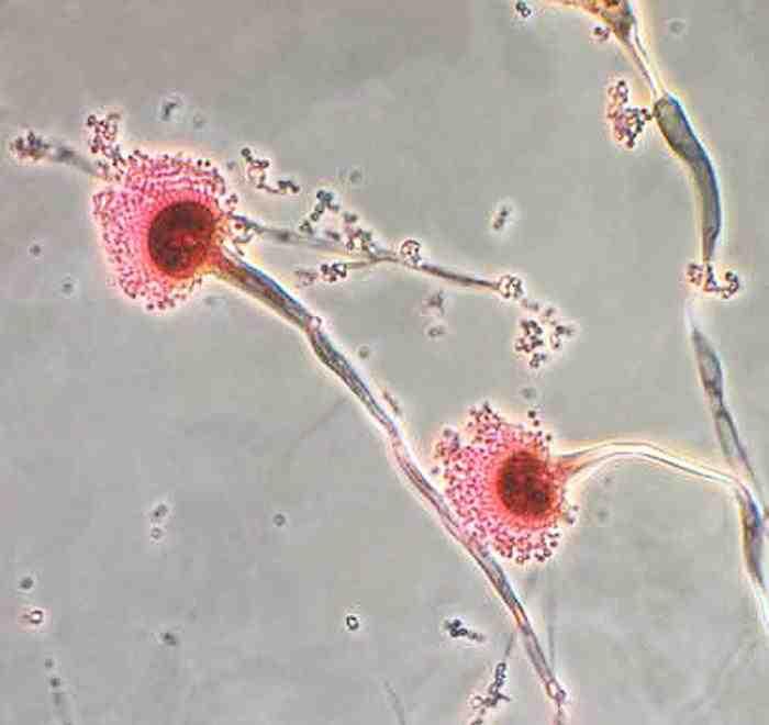 진균 03 2 Aspergillus spp.