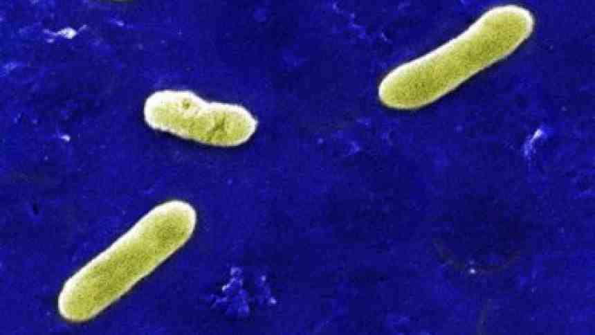 2017 병원체생물안전정보집 ( 제 2, 3, 4 위험군 ) 13 Bordetella parapertussis 위험군 : 제 2위험군 국내범주 :- 특성 :Alcaligenaceae과, 그람음성 출처 :Penn Srate University, US 병원성및감염증상 잠복기 :7~10