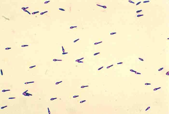 세균 01 24 Clostridium botulinum 위험군 : 제 2위험군 국내범주 : 고위험병원체, 생물작용제, 전략물자통제병원체 특성 :Clostridiaceae과, 그람양성, 포자형성, 무산소성 출처 :CDC/ Dr.