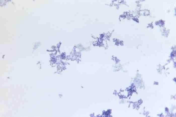 세균 01 30 Corynebacterium spp.(c. bovis, C. jeikeium, C. pseudotuberculosis, C, renale, C. ulcerans) 위험군 : 제 2위험군 국내범주 :- 특성 :Corynebacteriaceae 과, 그람양성, 막대균, 포자형성안함, 운동성없음, 산소성 Corynebacterium sp.