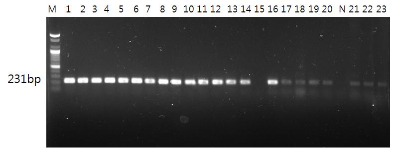 Korean J Clin Lab Sci. Vol. 45, No. 1, Mar. 2013 19 Fig. 3. Electrophoresis of the amplified products of VanA (231 bp), VanB (330 bp) genes. By a duplex PCR in a 1.5% agarose gel.
