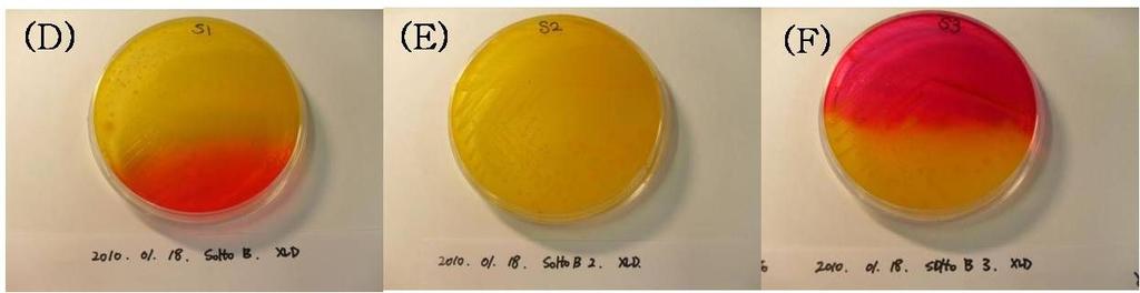 The morphology of Salmonella Typhimurium on XLD