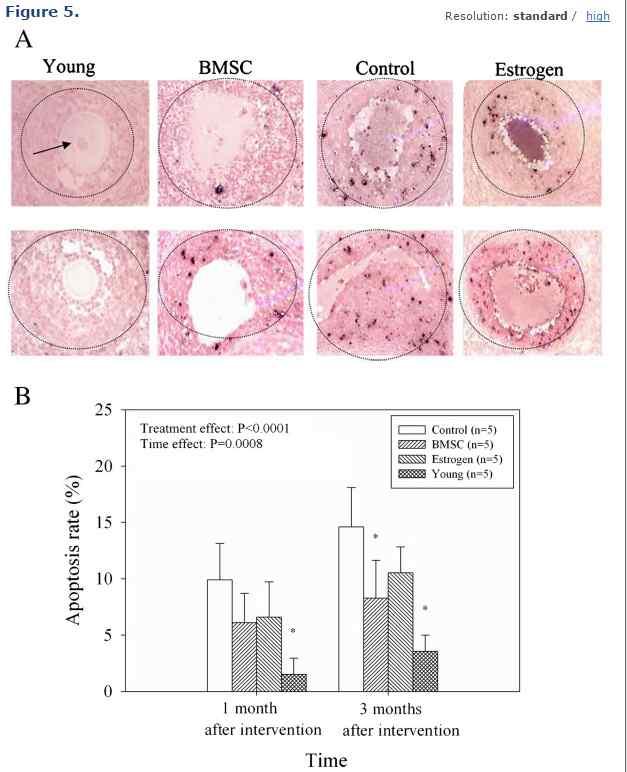 연구결과 (Results) Figures and tables Effects of BMSCs in an in vivo model of perimenopause. GC apoptosis was assessed by TUNEL staining.