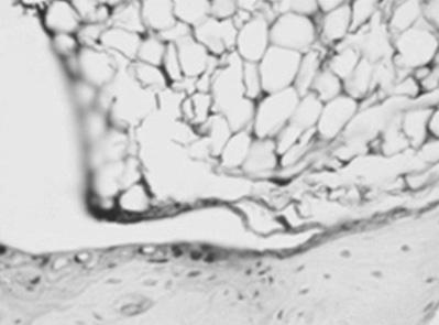 관절염유도군의관절은침윤된세포내많은양의 IL-1β, TNF-α, IL-6와