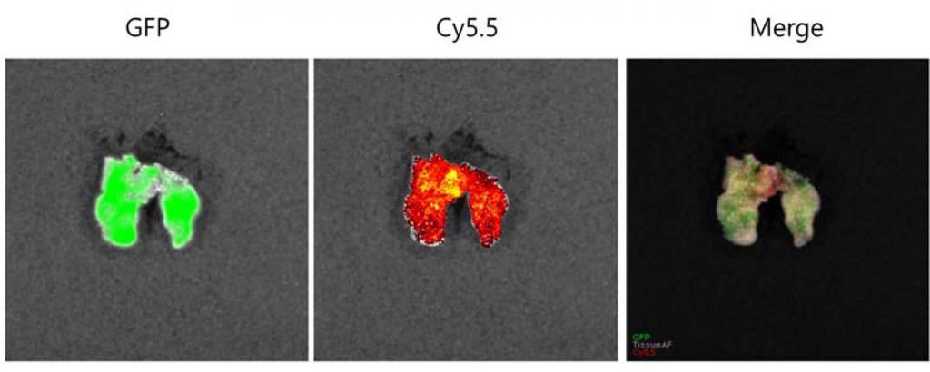 Fig. 6. Representative ex vivo optical imaging of lung tissue 6h after intravenous injection of Cy5.5-DFO-LPNs. 을관찰하였다.