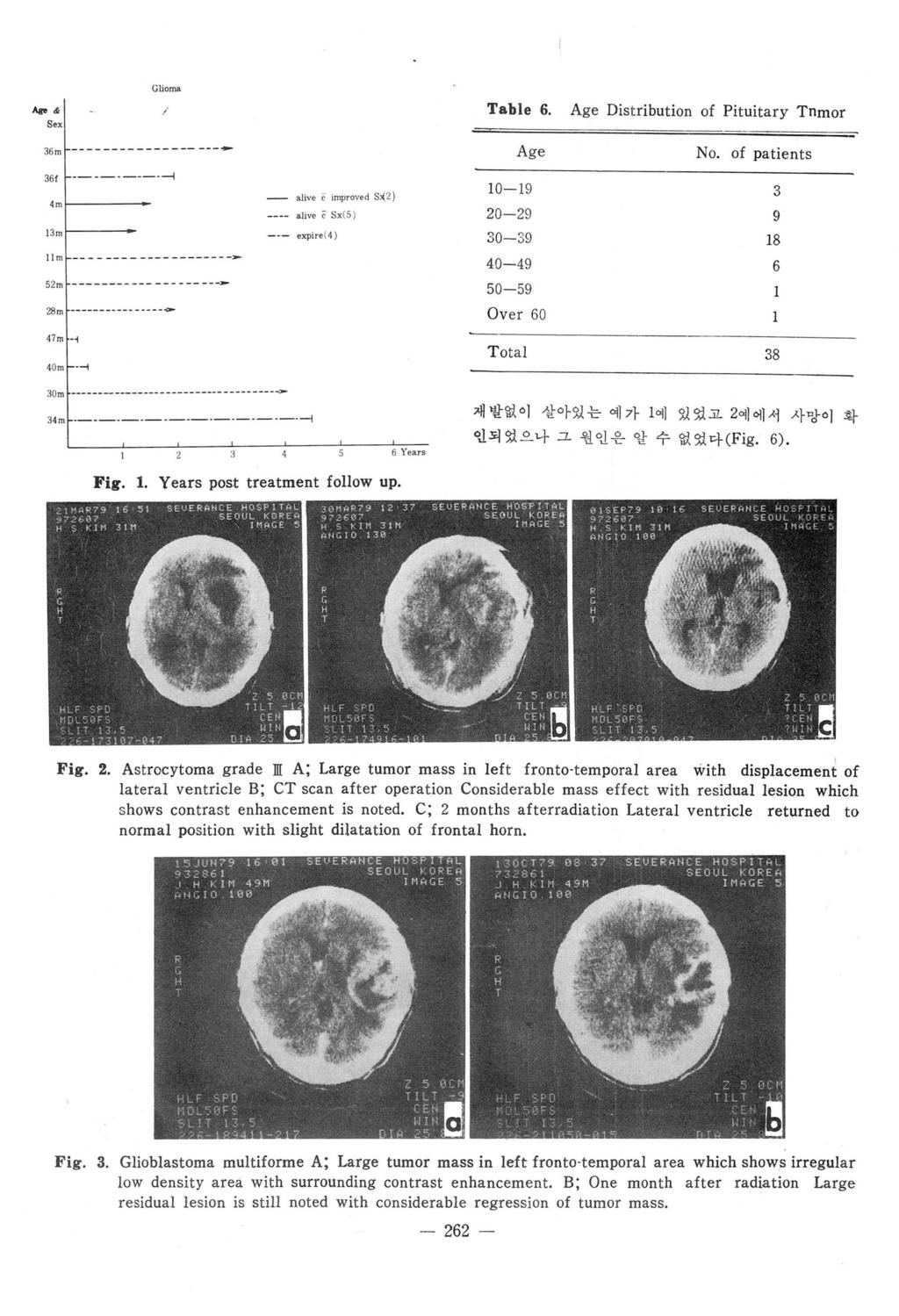 Glioma Age& Sex Table 6. Age Distribution of Pituitary Tnmor 36m 1--- - - -- - - - ------ ---~ Age No.