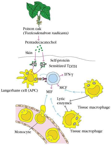 T DTH -mediated(typeⅣ) hypersensitivity - TypeⅣ reaction은 antigen이 sensitized 된 T DTH cell을 activation시킴으로서진행된다. antigen에의해 T DTH cell이 activation되면 IL-2, INF-γ, MIF, TNF-β등의다양한 cytokines들을분비한다.
