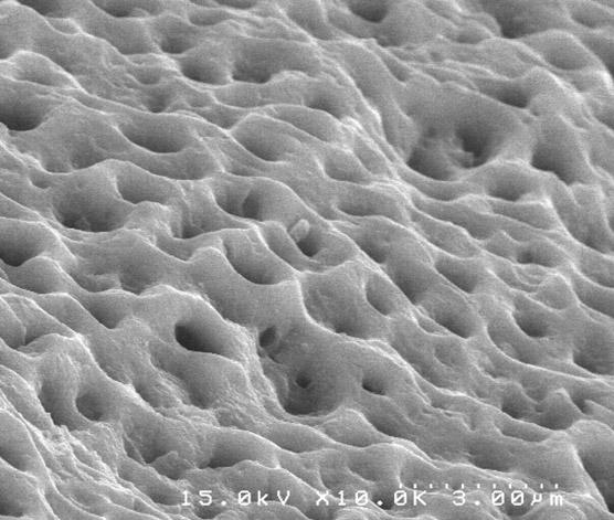 A B Fig. 12. Scanning electron micrographs of the implant surface ( 10,000). A: The rough surface with regular sized pores on titanium.
