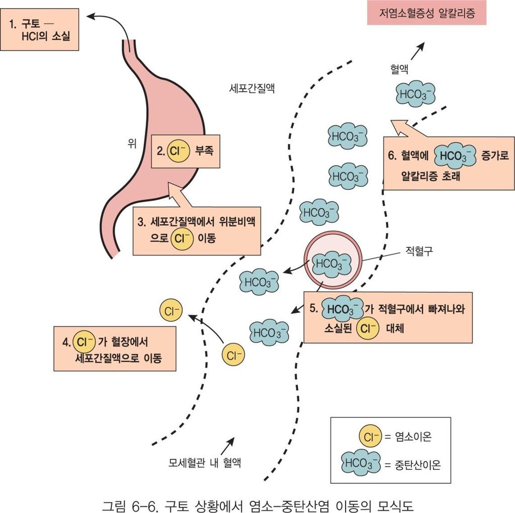 (hypochloremia) 원인 : 구토초기, 과도핚발핚 영향 :