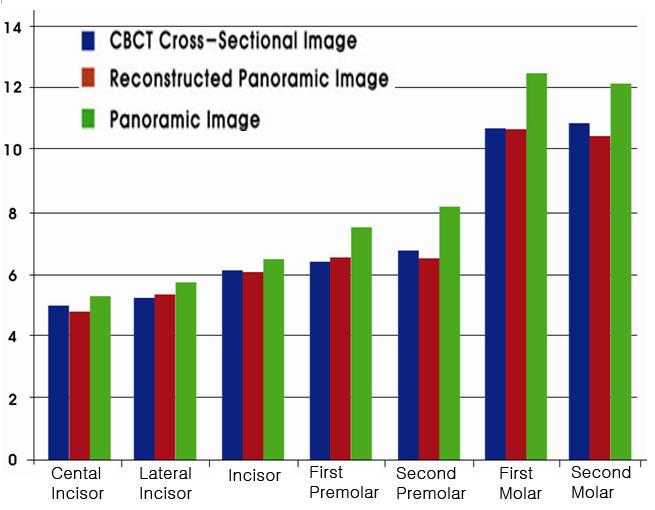 Classifications Panoramic Image Reconstructed Panoramic Image CBCT Cross-sectional Image Central Incisor 5.21 ± 0.60 4.84 ± 0.24 4.87 ± 0.20 Lateral Incisor 5.77 ± 0.80 5.22 ± 0.27 5.19 ± 0.