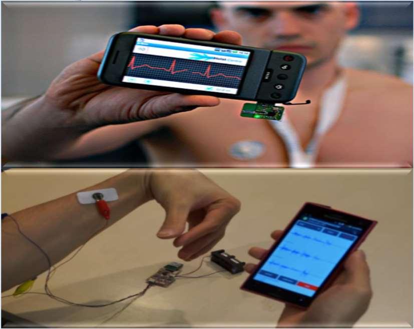 독립트랙 ( 지도교수 : 안종현 ) Wireless electrophysiological signal measuring system with smartphone application 생체신호측정용무선웨어러블기기를구현과스마트폰어플리케이션 ECG 그림 1.