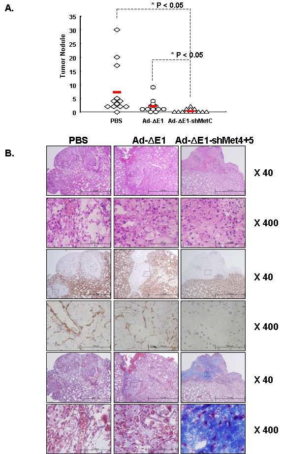 Figure 26. Therapeutic efficacy of Ad- E1-shMet4+5 on MDA-MB-231 lung metasis tumor model. (A) MDA-MB-231 human breast cancer cells were injected intravenously to form pulmonary metastatic lesions.