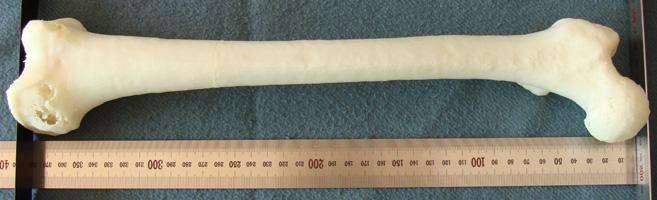 "Additive Manufacturing of Patient-specific Femur Via 3D Printer Using Computed