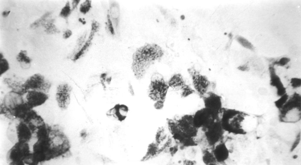 김우정 외 B A Fig. 3. Cultured cell on cover slips (AB-PAS stain, 200). A cells after 2 days, B cells after 4 days, C cells after 6 days.