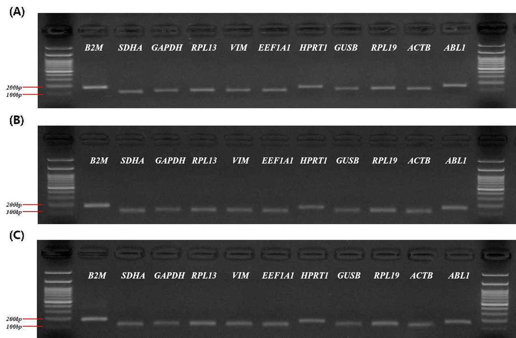 Expression stability analysis of housekeeping genes 155 구를통합하여모든하우스키핑유전자를비교하는웹- 기반소프트웨어 RefFinder(https://www.heartcure.com.au/ reffinder/?type=reference#) 를통해전체안정성순위를정했다.